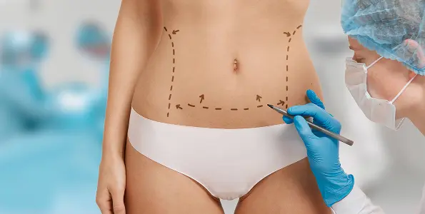 Liposuction in Indiana