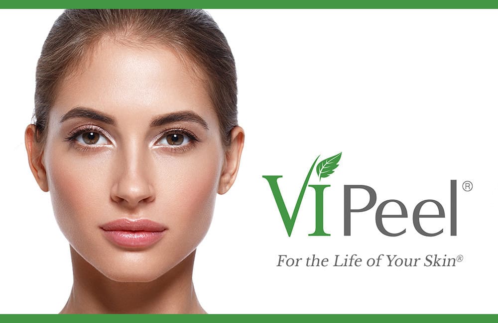 products news ViPeel3 21060 1683391758 1280 1280 26210 1698694963 1280 1280