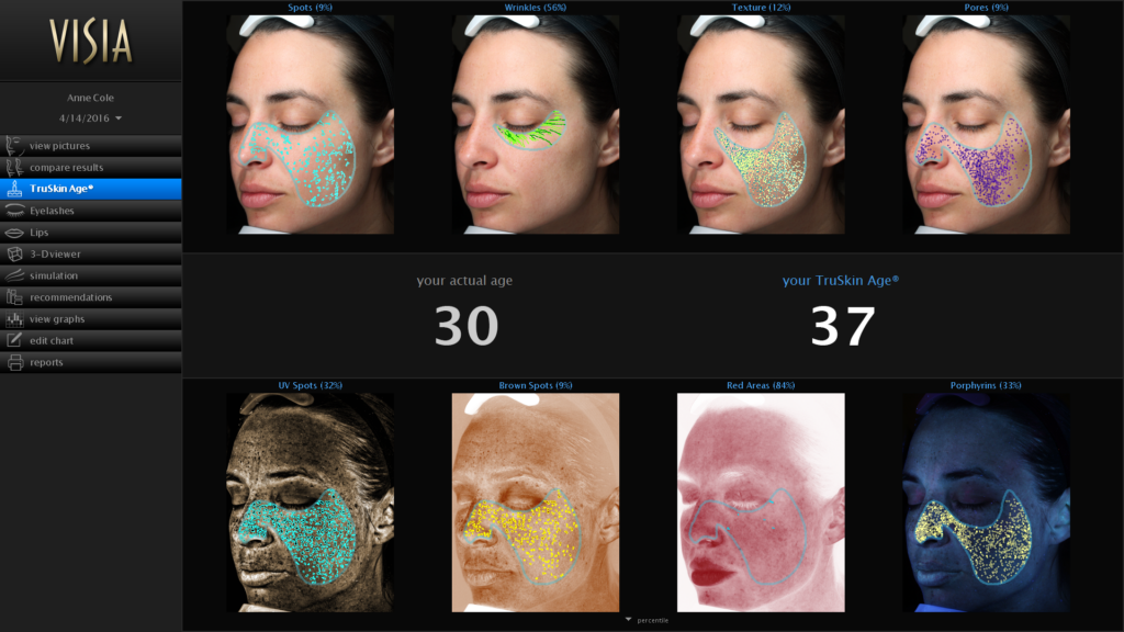Blog post images (2)